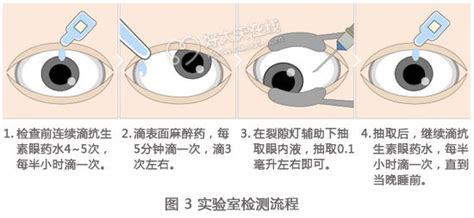 水波紋 眼睛